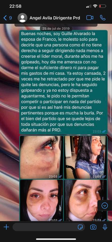 Esposa de Rogelio Franco comparte en redes imágenes y su postura respecto al apoyo que brinda PRD estatal y Nacional al señalado de agresión