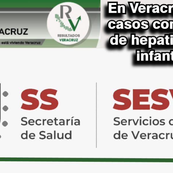 En Veracruz no hay casos confirmados de hepatitis aguda infantil: SS